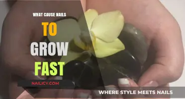 How Diet and Lifestyle Affect Nail Growth