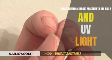 Gel Nails and UV Light: Allergic Reaction Triggers