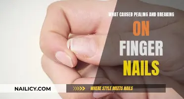 Understanding Nail Peeling and Breaking: Causes and Solutions