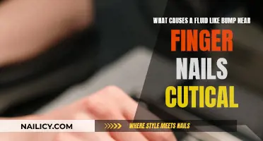 Fluid-like Bump Near Nails: What's the Cause?