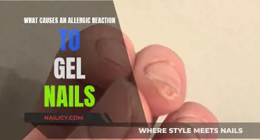 Gel Nails Allergies: Causes and Symptoms Explained