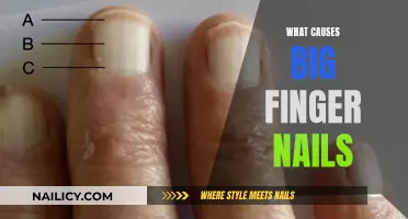 Unusually Large Nails: Why and What to Do About It