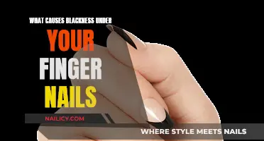 Blackness Under Fingernails: What's the Cause?