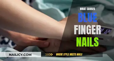 The Mystery of Blue Fingernails: Causes and Concerns