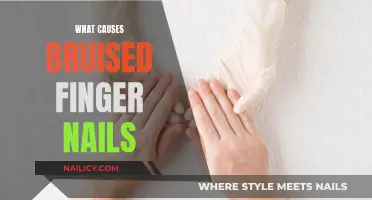 The Mystery of Bruised Fingernails: Causes and Concerns