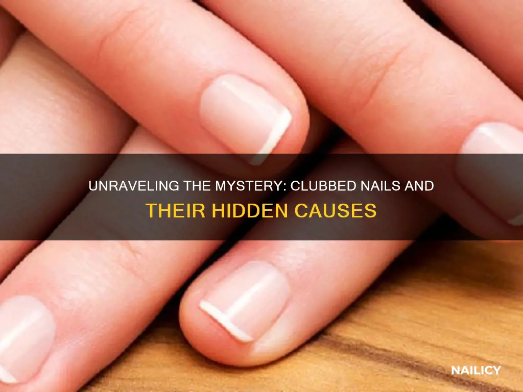 what causes clubbed finger nails