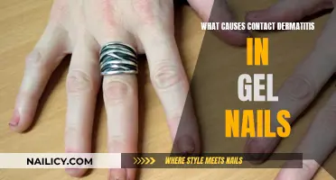 Gel Nails Contact Dermatitis: What's the Cause?