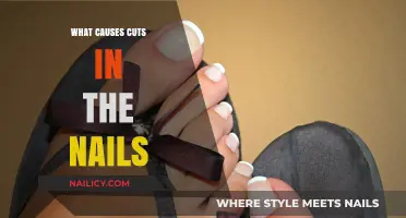 Nail Trauma: Understanding the Causes of Nail Cuts and Tears