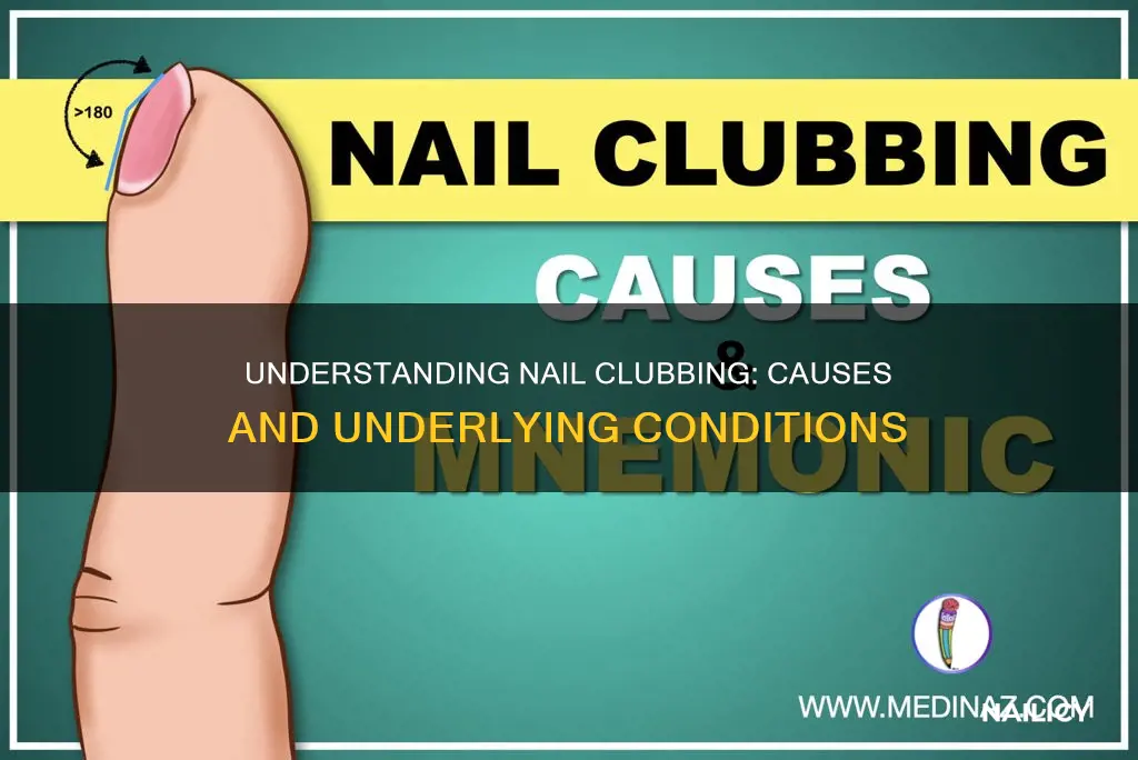 what causes finger nail clubbing
