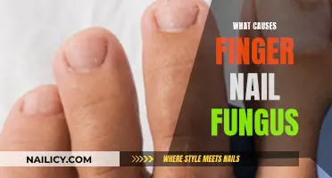 The Mystery Behind Finger Nail Fungus Causes