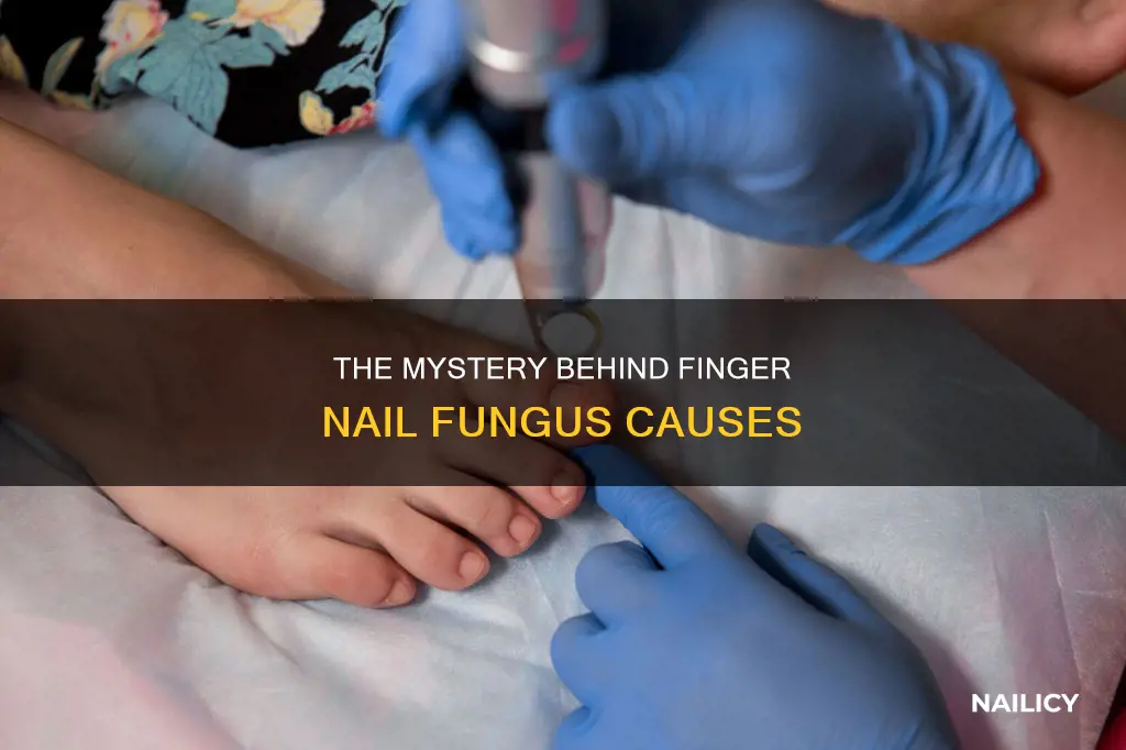 what causes finger nail fungus