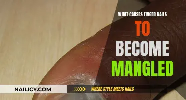 The Mystery of Distorted Nails: Causes and Concerns