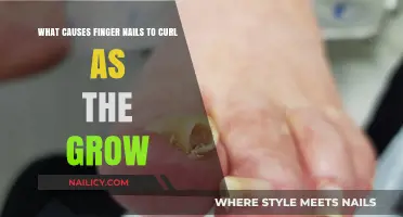 Why Do Fingernails Curl as They Grow?