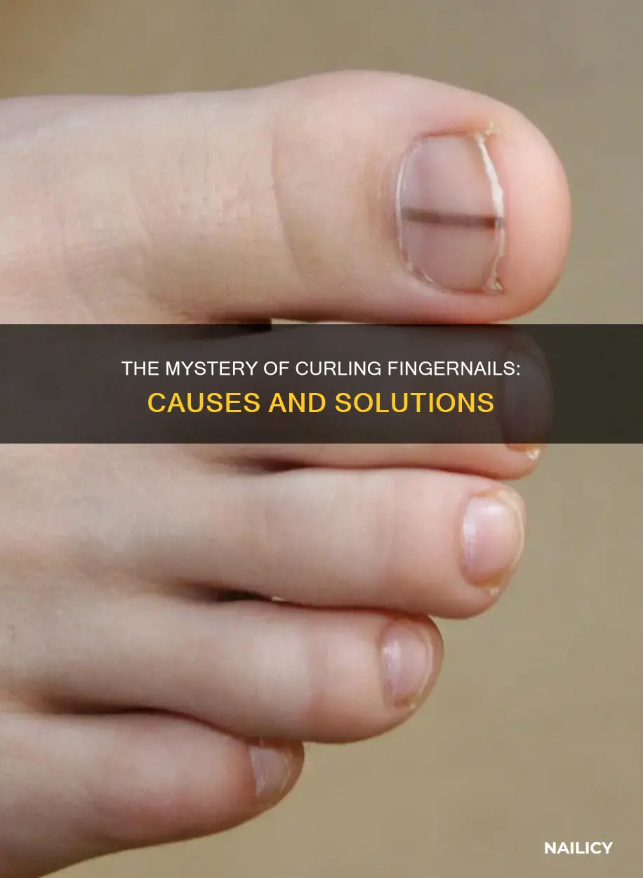 what causes finger nails to curl
