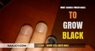 Black Fingernails: What's the Cause?