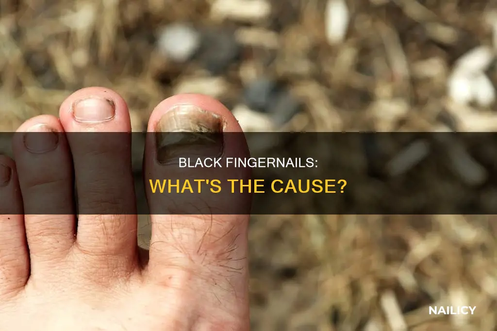 what causes finger nails to grow black