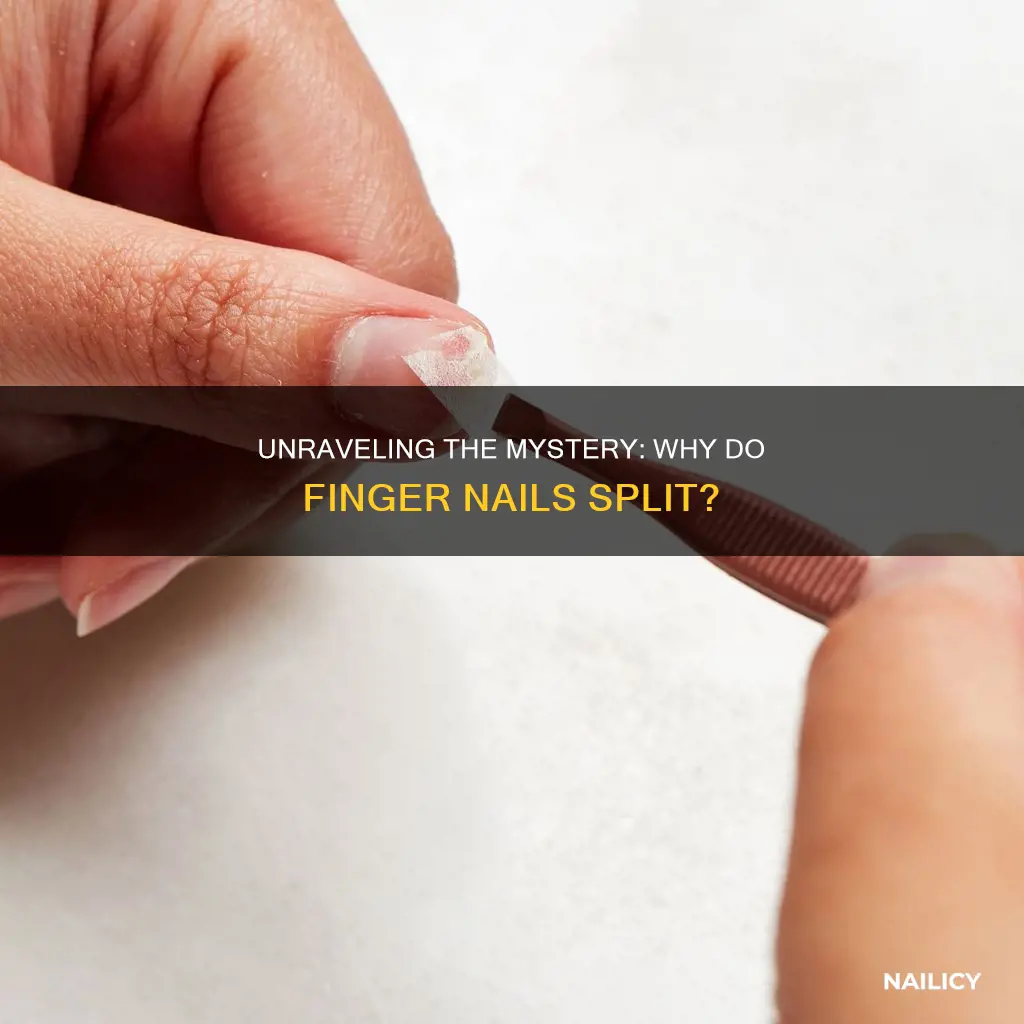 what causes finger nails to split