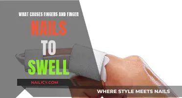 Understanding Swelling Fingers and Nails: Causes and Triggers