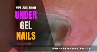 Fungus Under Gel Nails: Causes and Prevention Tips