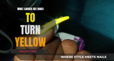 Gel Nails Turning Yellow: What's the Culprit?