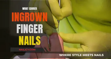 Ingrown Nails: Causes and Triggers Explained