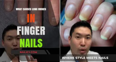Ridges on Fingernails: What's the Cause?