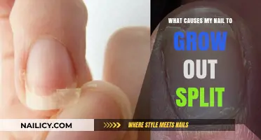 Nail Splitting: Why It Happens and How to Fix It