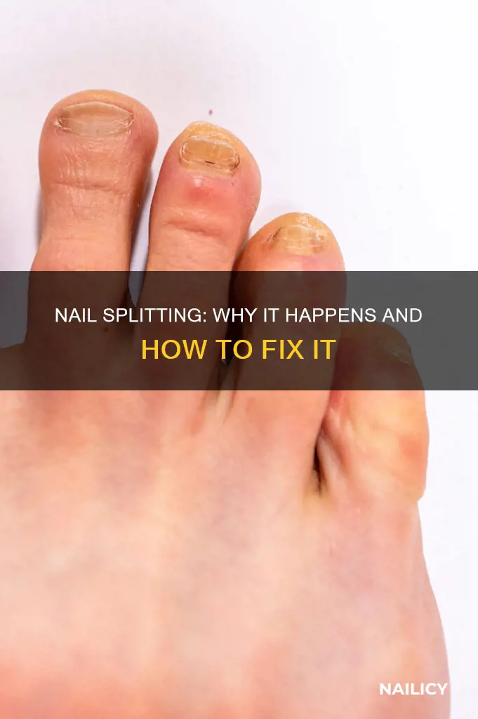 what causes my nail to grow out split