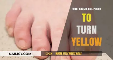 Why Nail Polish Turns Yellow: Causes and Prevention Tips