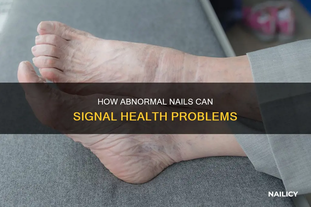 what causes nails to grow bent