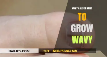 Nail Woes: Why Do Nails Grow Wavy?