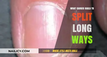 Nail Splitting: Reasons and Remedies