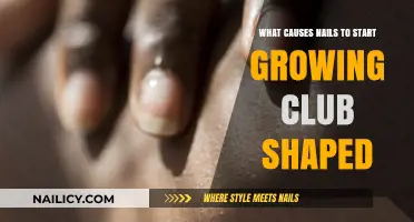 Clubbed Nails: Causes and Concerns
