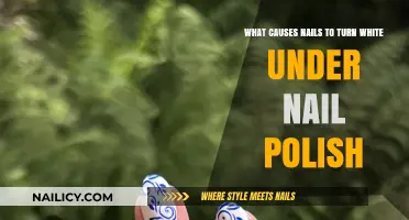 Why Nails Turn White Under Polish: Causes and Prevention Tips