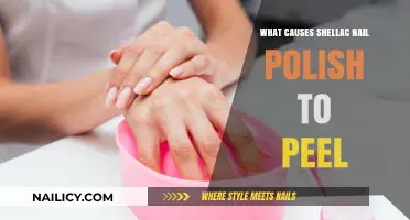 Why Shellac Nail Polish Peels: Causes and Prevention Tips