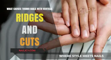 Vertical Nail Ridges: What's Causing Them?