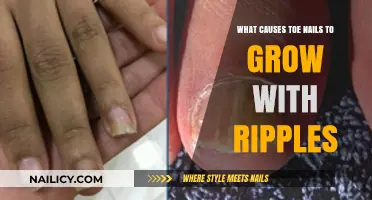Toe Nail Texture: What's Causing Those Ripples?