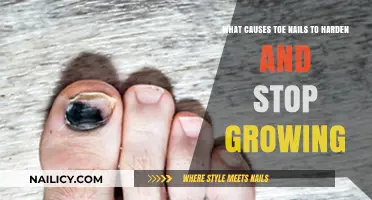 Toe Nail Hardening: Causes and Growth Solutions