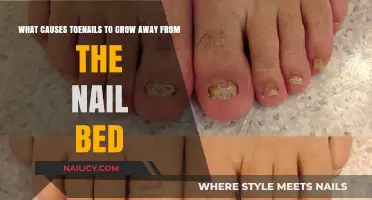 Toenail Trauma: Why Nails Grow Away from the Bed
