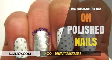 Why White Marks Appear on Polished Nails: Causes and Prevention