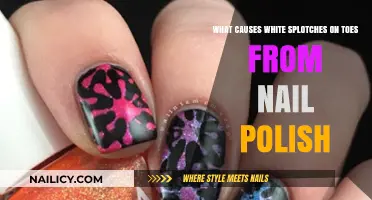 Why Nail Polish Leaves White Splotches on Your Toes: Explained