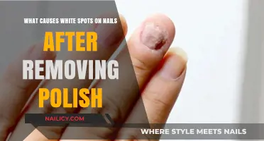 Understanding White Spots: Post-Polish Nail Care