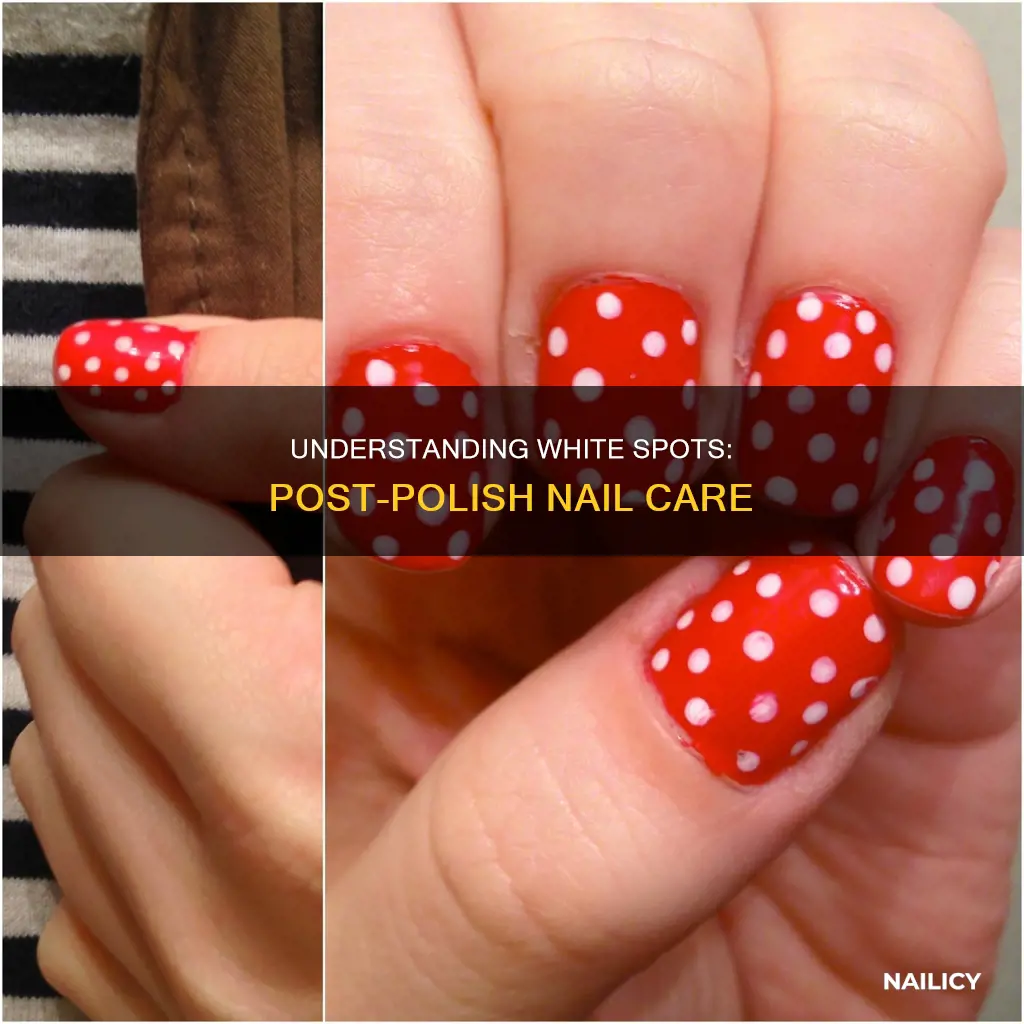 what causes white spots on nails after removing polish