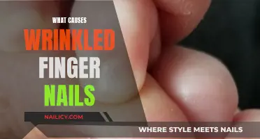 Wrinkled Finger Nails: What's the Underlying Cause?