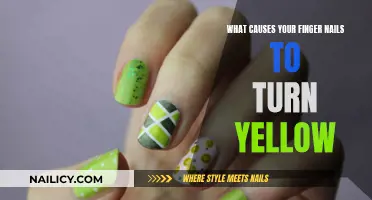 Yellow Nails: What Are the Causes?