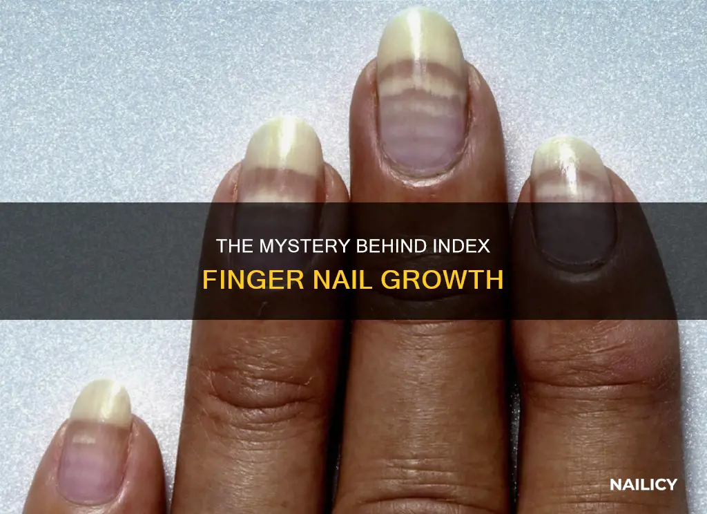 what causescreas in index finger nail