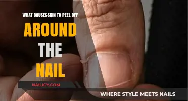 Why Skin Peels Around Nails: Causes and Solutions Explained