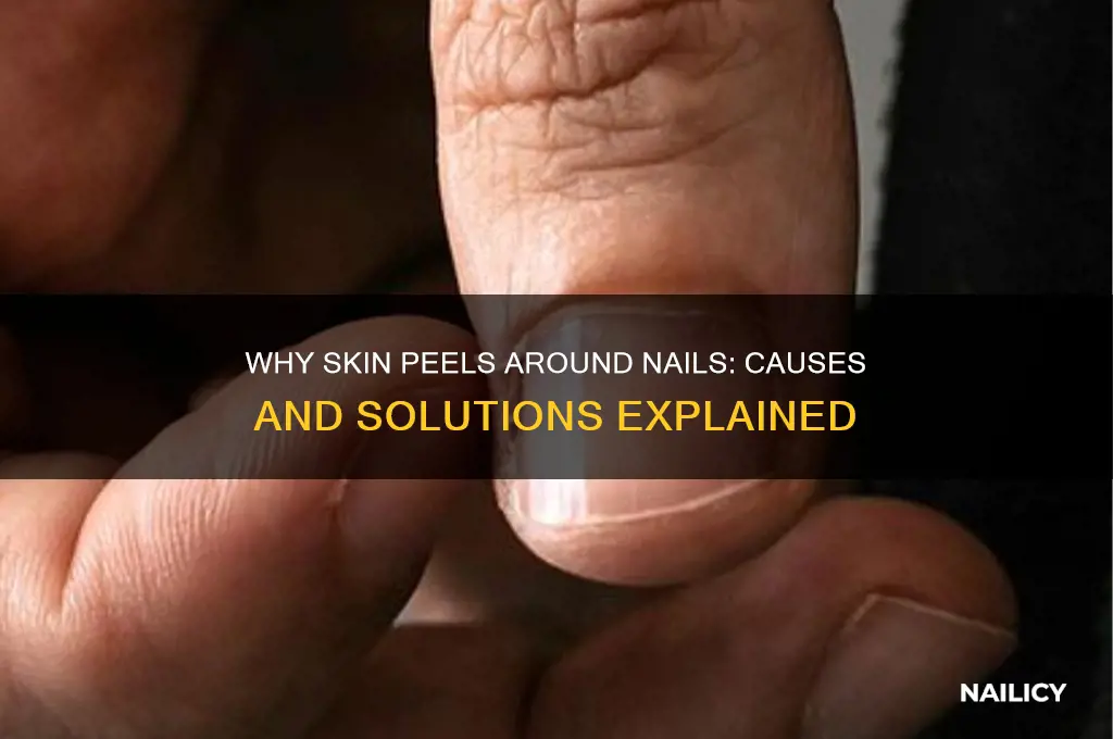 what causesskin to peel off around the nail