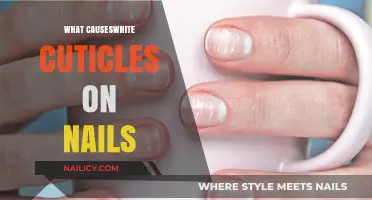 Understanding White Cuticles: Causes and Treatments for Healthy Nails