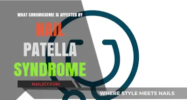 Nail Patella Syndrome: Understanding the Chromosome 9 Connection